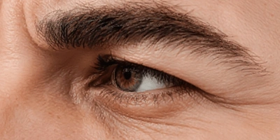 texture resolution